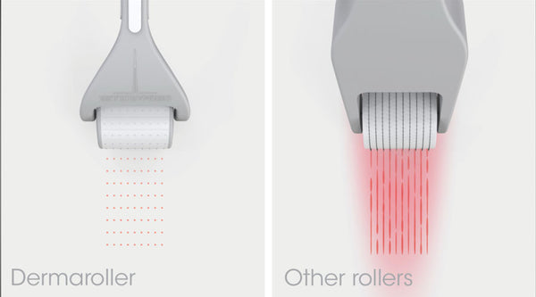 Home Care Roller by Dermaroller® - Totally Refreshed Steam and Spa