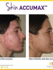 Load image into Gallery viewer, Skin Accumax 120 Capsules - Advanced Nutrition - Totally Refreshed Steam and Spa