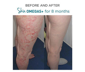 Skin Omegas+ 180 Capsules - Advanced Nutrition - Totally Refreshed Steam and Spa
