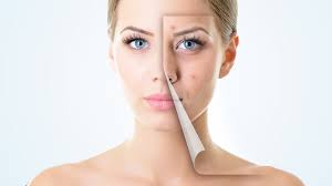 Skincare