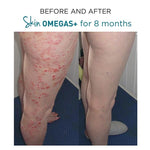 Load image into Gallery viewer, Skin Omegas+ 180 Capsules - Advanced Nutrition - Totally Refreshed Steam and Spa

