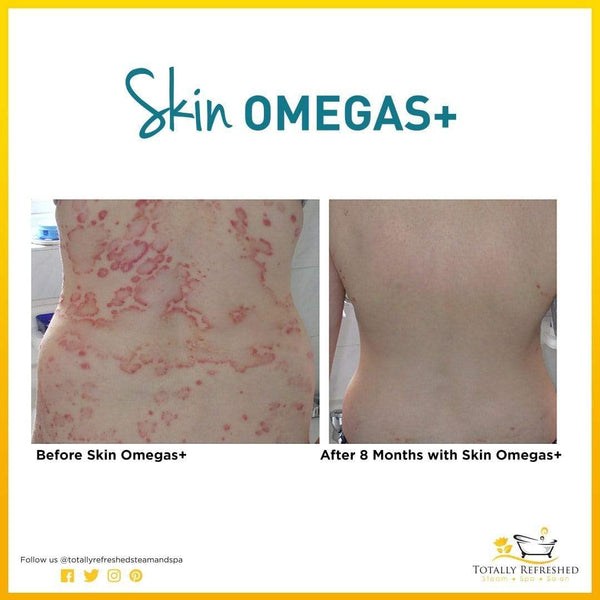 Skin Omegas+ 60 Capsules - Advanced Nutrition - Totally Refreshed Steam and Spa