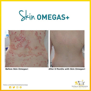 Skin Omegas+ 60 Capsules - Advanced Nutrition - Totally Refreshed Steam and Spa